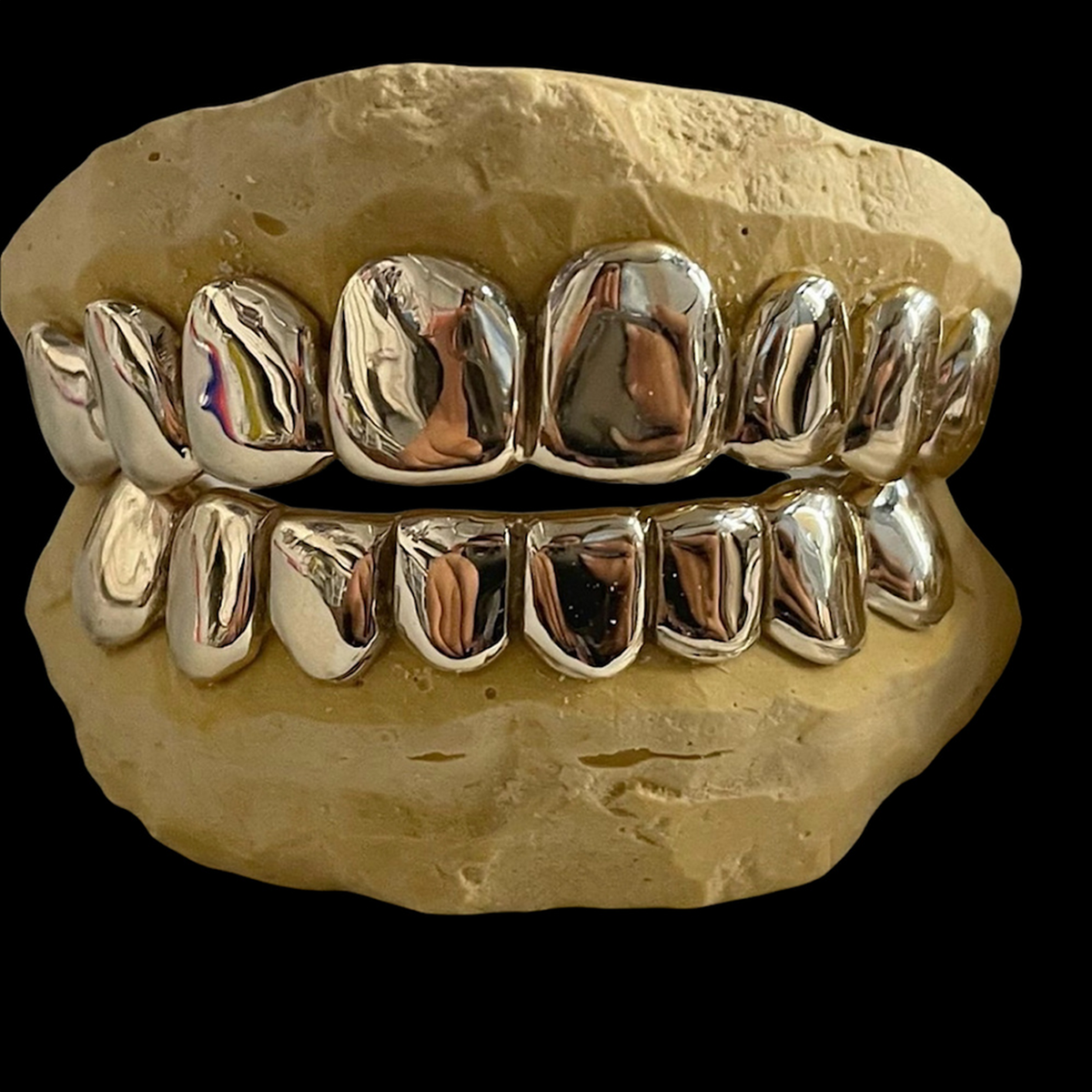 Custom Solid Gold Grillz