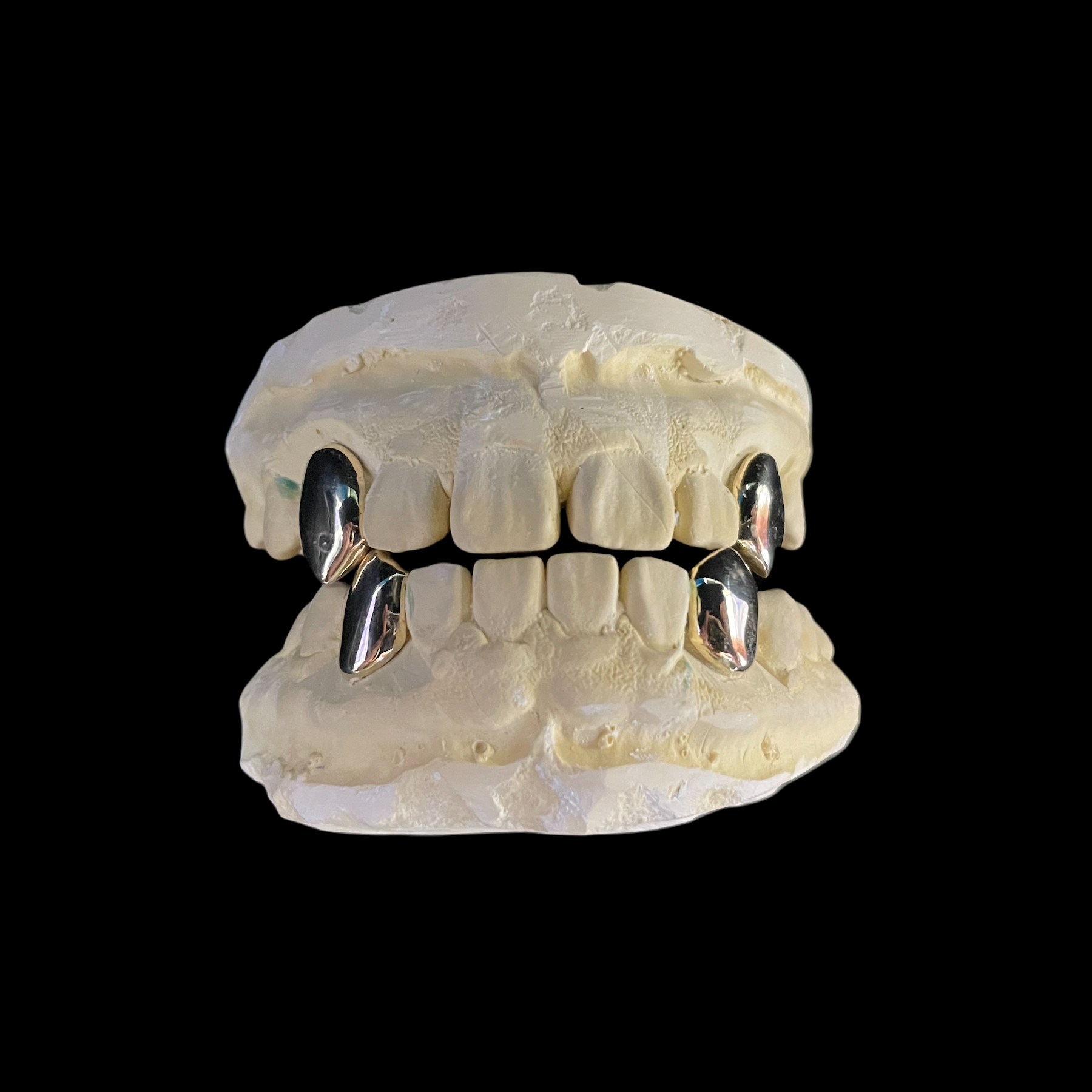 10k vs 14k Gold Grillz: What Is Difference Between Both the Karats?