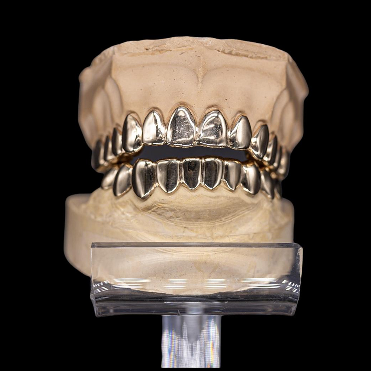 Custom Solid Gold Grillz