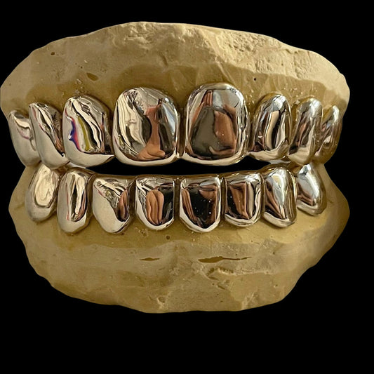 Custom 925 Sterling Silver Grillz on dental mold